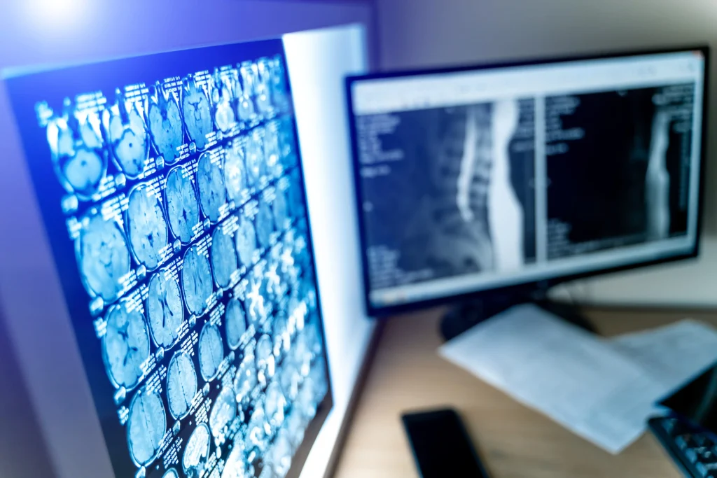 Imaging medicale e DICOM